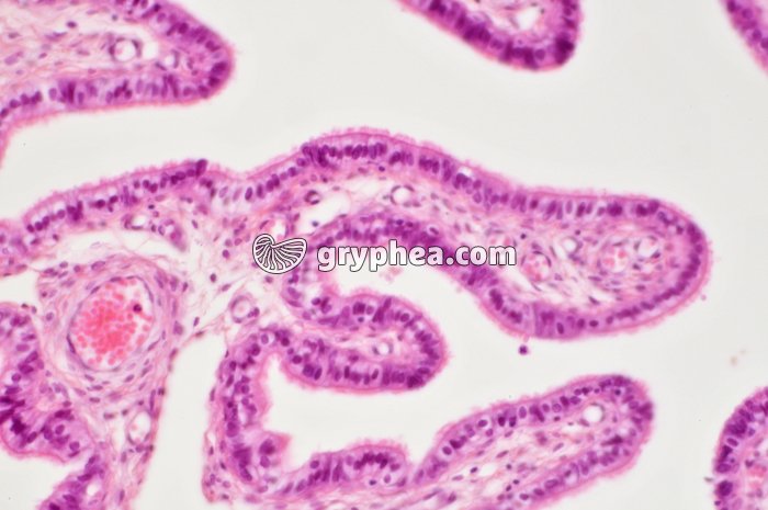 Trompe de Fallope x100 - gryphea.com